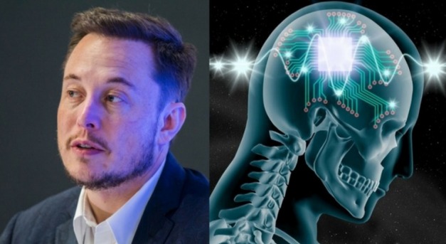 Az emberi agy és a számítógép közötti „ideghálózatot” fejleszt Elon Musk cége