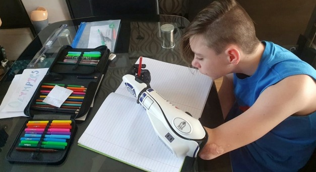 Bionikus kar segítségével tanult meg újra írni