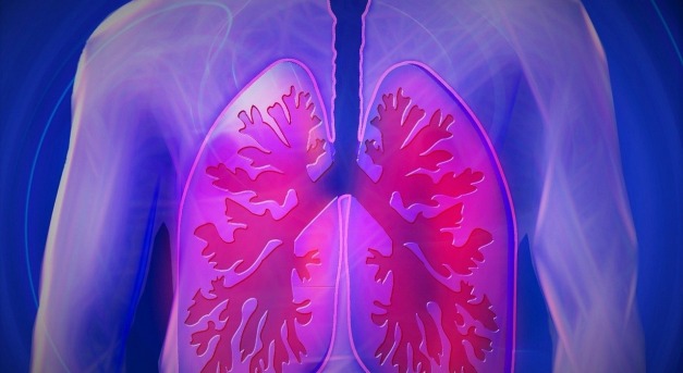 Korszerű terápiával krónikus betegséggé „szelídülhet” a tüdőrák
