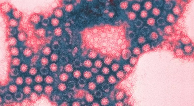 A járványelemző szerint egy hónap múlva súlyosbodhat a fertőzöttségi helyzet